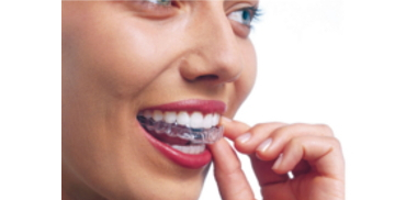 Aparate dentare invizibile